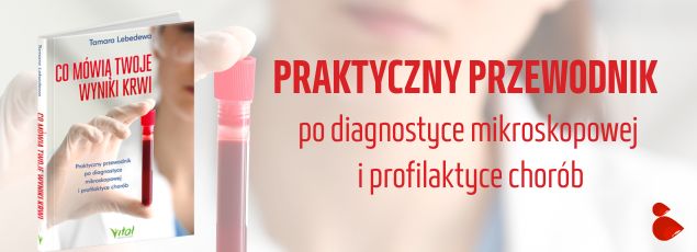 Co mówią twoje wyniki krw